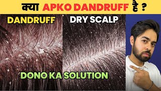 Say Goodbye to Dandruff or Dry Scalp HONEST SOLUTIONS [upl. by Ardnuhsed993]