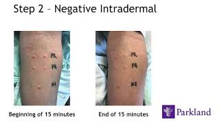 How Penicillin Allergy Testing is Done [upl. by Aitnuahs]