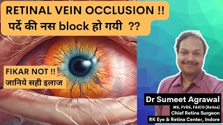 पर्दे की नस block हो जाए Retinal Vein Occlusion तो क्या करें [upl. by Ayot]