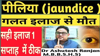 Jaundice  Liver disease के गलत इलाज से मौत सही treatment से 1 सप्ताह में ठीक [upl. by Atteuqnas]