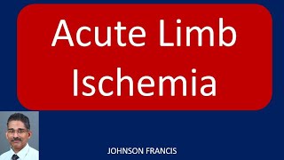 Acute Limb Ischemia [upl. by Ydnir96]