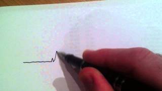 A Normal Regular Heart Beat and Electrocardiogram ECG or EKG [upl. by Eciened]