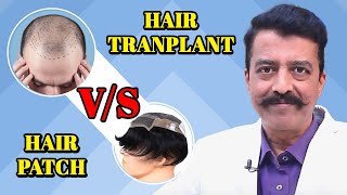 Hair Transplant or Hair Patch  Which Option is Better in Hindihairtransplantcentre [upl. by Zetnod]