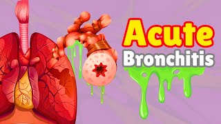 What is Acute Bronchitis  Causes Symptoms Treatments amp More… [upl. by Nikolia381]