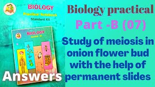 study of meiosis in onion flower bud biology practical class 12 experiment 7 part B answers [upl. by Appleton]