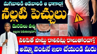 How To Remove Private Part Itching Overnight  Fungal Infections  Dr Manthena Satyanarayana Raju [upl. by Negiam]