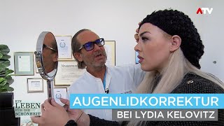 Augenlidkorrektur bei Lydia Kelovitz  Beratung Behandlung amp Kontrolle  Dr Jörg Knabl [upl. by Cassilda583]