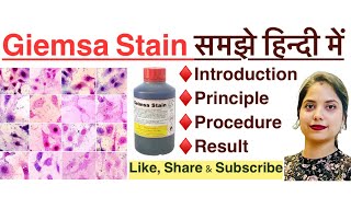 Giemsa stain in Hindi  principle  procedure  result  MLT  histopathology  Haematology [upl. by Koziara445]