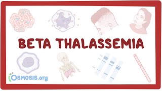 Betathalassemia  causes symptoms diagnosis treatment pathology [upl. by Steel299]