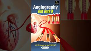 What is Angiography in Hindi angiography radiographerexam testpaperliveparamedicalclasses [upl. by Airbmak]