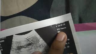 How to know baby boy or girl in ultrasound report part a  Aqsa Mehmood [upl. by Adnof]