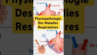 Physiopathologie Maladies Respiratoires pneumologie bronchite asthme fibrosepulmonaire poumon [upl. by Ellocin818]