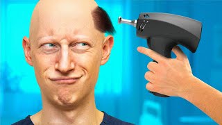 Top 5 NEW Hair Restoration Treatments YOU Need To Know About [upl. by Leclair]