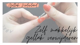 GELLAK VERWIJDEREN  Uitgebreide uitleg  Gellak Nederland [upl. by Reave]