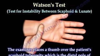 Examination Of The Hand Tests  Everything You Need To Know  Dr Nabil Ebraheim [upl. by Laubin]