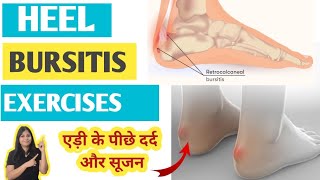 Heel bursitis exercises  Retrocalcaneal bursitis  एड़ी के पीछे दर्द [upl. by Anilave]