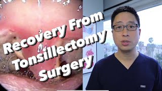 PostTonsillectomy Overview pain control diet bleeding concerns physical limitations [upl. by Diamond377]