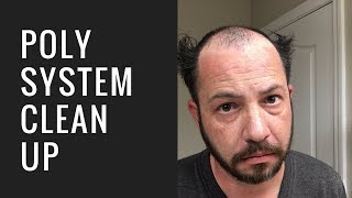 Hair Replacement Mens Hair System Review Poly System Cleanup [upl. by Hgieliak]