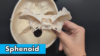 Sphenoid Bone [upl. by Ruscher]