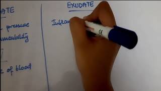 Pleural Effusion  EXUDATE vs TRANSUDATE  Lights criteria [upl. by Icats]