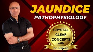 Pathophysiology Of Jaundice  Dr Najeeb Lectures [upl. by Kimberli]