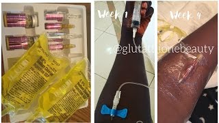 Glutathione Injection Whitening for black skin [upl. by Eckhardt]