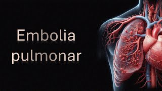 Embolia pulmonar [upl. by Xxam]