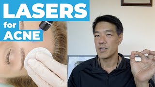 Acne Treatments with Lasers  Dr Davin Lim [upl. by Peursem628]