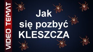 Jak usunąć kleszcza  Skuteczne sposoby na kleszcze [upl. by Kanter]