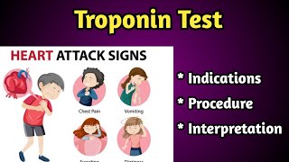 Troponin Test for Heart Procedure Detailed Video [upl. by Esenaj280]