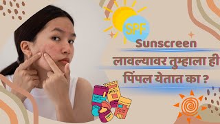 Sunscreen लावल्यावर तुम्हाला ही पिंपल येतात काWhy Do We Get Pimples After Using Sunscreen [upl. by Nelan]