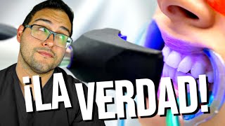 ¡LO QUE NADIE TE DICE 🚫 DEL BLANQUEAMIENTO DENTAL 💔 Deberías ver este vídeo 👀 [upl. by Eninnaej]