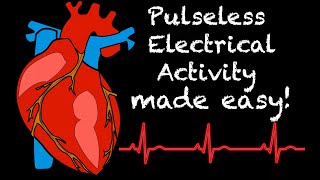 EMS Cardiology  Tachy Tuesday Pulseless Electrical Activity PEA in EMS [upl. by Lhary]