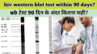 when we should go with western blot test for hiv western blot test accuracy within 90 days [upl. by Chastity594]