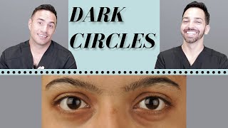 Dark Circles Causes amp Treatments  Dermatologist Perspective [upl. by Behlau]