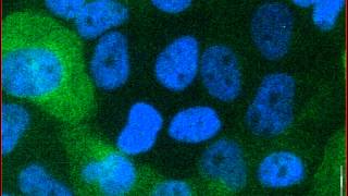 Mitotic catastrophe triggered in human cancer cells by the viral protein apoptin  movie A [upl. by Templer]