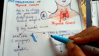 pathogenesis of thyroid cancer NGMedicals [upl. by Mad]