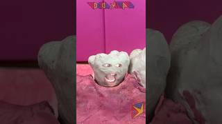 La Amalgama Dental 🦷shortvideo [upl. by Eedya859]