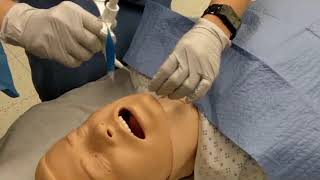 Surgical tracheostomy procedure [upl. by Silda]