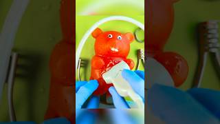 Gummy Surgery Fail😩💔🪦Satisfying Csection flatline DiscountDentist FruitSurgery FoodSurgery [upl. by Koball110]