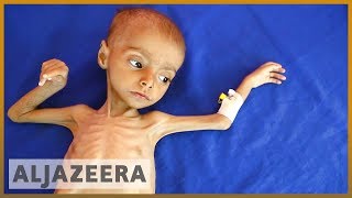 🇾🇪 19 million Yemeni children suffer malnutrition and illness l Al Jazeera English [upl. by Joyann]