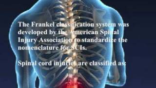 NCLEX  MSNursingReviewonACUTE SPINAL CORD INJURY [upl. by Brandtr131]