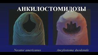 Анкилостомидозы Анкилостомоз Ancylostoma duodenale и Некатороз Necator americanus [upl. by Saihttam]