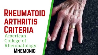 Rheumatoid Arthritis criteria by American College of Rheumatology Mnemonic [upl. by Tillio771]