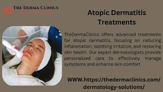 Allergic Dermatitis Treatment [upl. by Aneerehs]