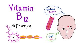 Vitamin B12 Cobalamin Deficiency  Causes Symptoms Diagnosis amp Management  Hematology Series [upl. by Eneloc]