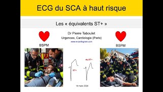 ECG du syndrome coronaire aigu Les équivalents ST à haut risque P Taboulet [upl. by Mathia]