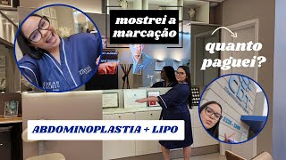 ABDOMINOPLASTIA  LIPO  MOSTREI A MARCAÇÃO  QUANTO PAGUEI MEDHOSPITAL  DR ÍCARO SAMUEL [upl. by Ocana]