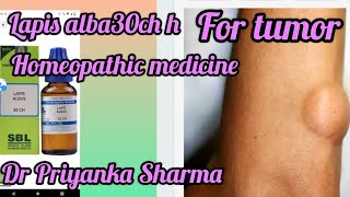 lapis Alba homeopathic medicine for Lipoma and tumorlapis Alba 30 uses in hindi [upl. by Maida]