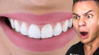 Dentist Reveals Secret To The PERFECT Smile [upl. by Rainger]